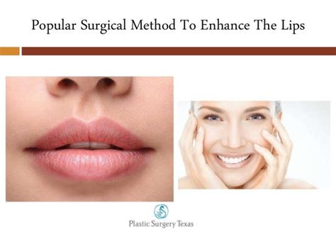 Most Advanced Lip Plumping Injections