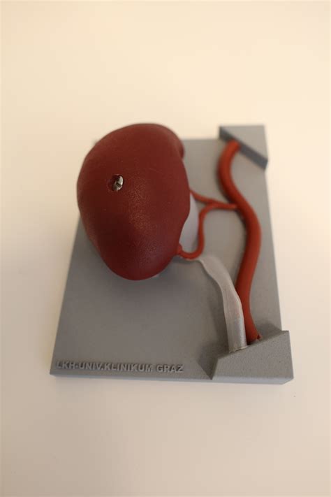 3D Printed Kidney Is A Better And Cheaper Training Tool