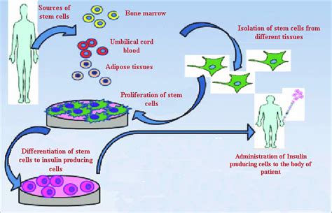 Human Insulin History Recent Advances And Expression Systems For