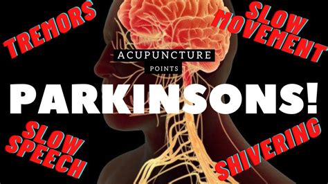 Parkinson Tremors Parkinsonism Parkinson S Disease Hindi Disease