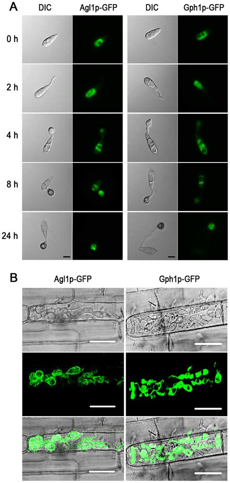 Localization Of Agl Gfp And Gph Gfp During Different Stages Of