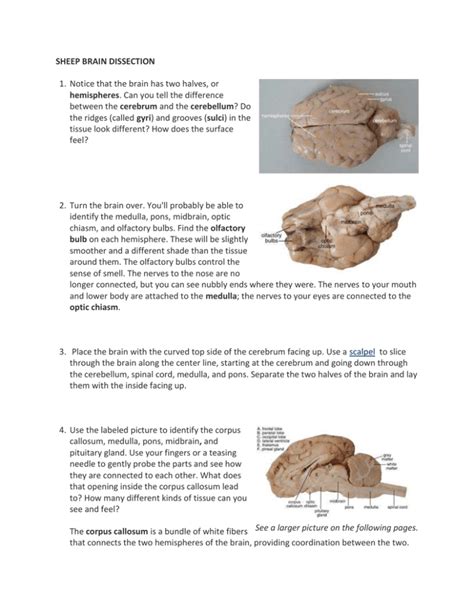 Sheep Brain Dissection Instructions