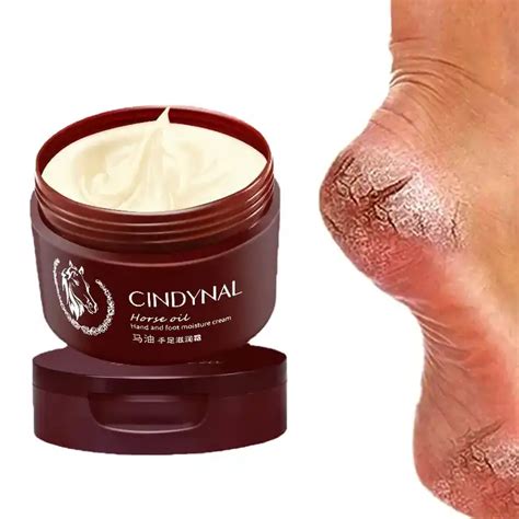 Anti Fungal Foot Repair Foot Cream Dead Skin Removal Peeling ...