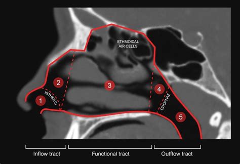 1 Sagittal cross-section from a CT scan showing the structural elements ...