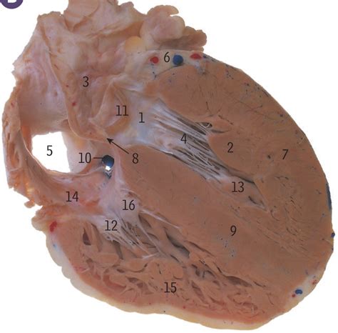 Head And Visceral Anatomy Practical Preparation Coronal Section Of The