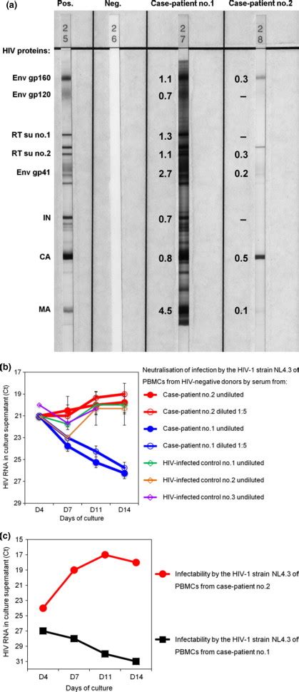 Hiv Western Blot Test