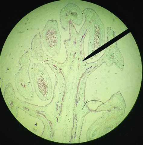 Gymnosperms Lab Flashcards Quizlet