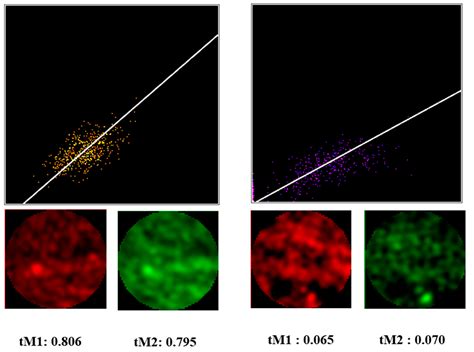 Biomedicines Free Full Text Colocalization Analysis Of Cytoplasmic