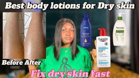 Best Moisturizing Body Lotions For Dry Skin Rough Skin Flaky Skin