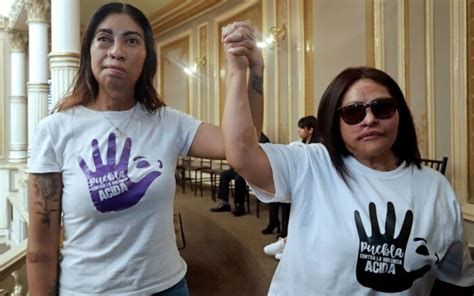 Aprueban La Ley Malena Que Busca Castigar La Violencia Con Acido