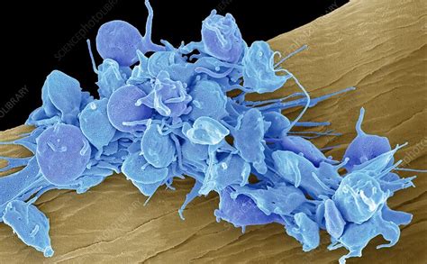 Activated Platelets SEM Stock Image C040 4229 Science Photo Library