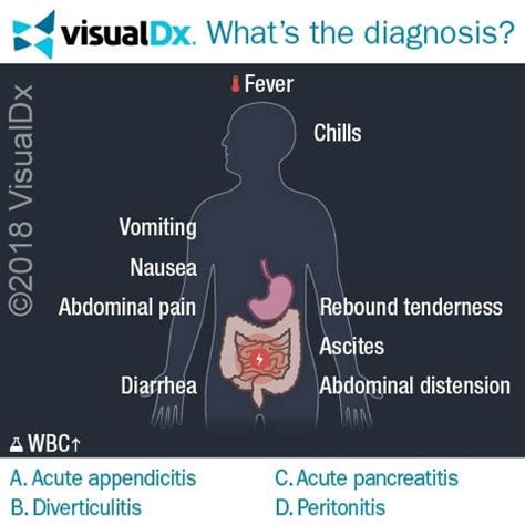 Stomach Pain, Fever, Chills Leads Man to the ER - Let’s Diagnose | VisualDx