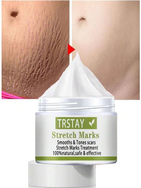 G G G G G Trstay Stretch Mark Cream Removes Scars And Marks