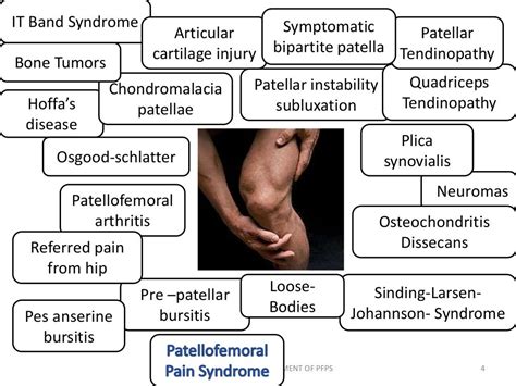 Patellofemoral Pain Syndrome Pfps