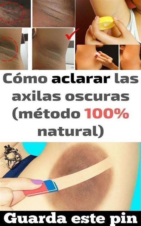 Abraza Tu Belleza Natural Una Receta Para Eliminar Las Manchas Oscuras