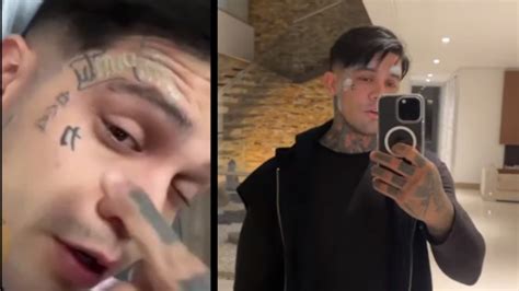 Video Yeferson Cossio Se Retira Los Tatuajes De Su Rostro Minuto