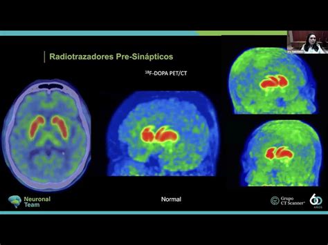 Videos Grupo CT Scanner