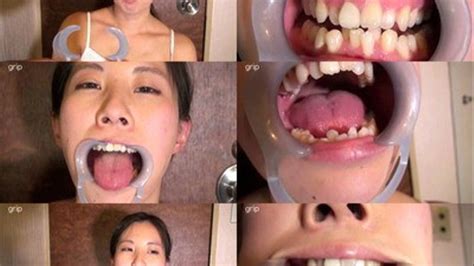 Misaligned Teeth And Wet Tongue Exposed Part 1 High Quality Deviant Dentist Mouth Fetish