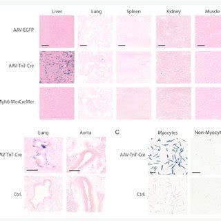 Specificity Of AAV TnT Cre Mediated Gene Transfer A Representative