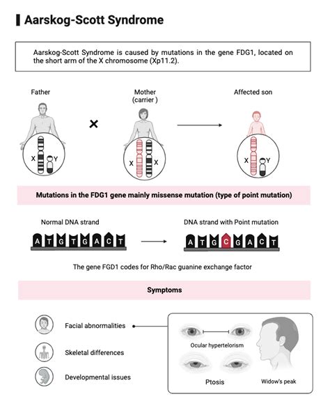 Aarskog-Scott Syndrome | BioRender Science Templates