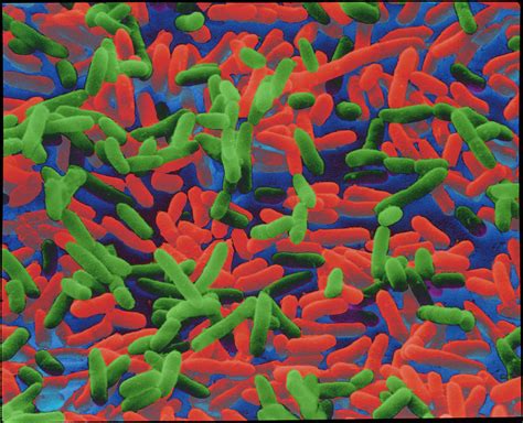 Coloured Sem Of Escherichia Coli Bacteria Photograph By Nibsc Fine Art America