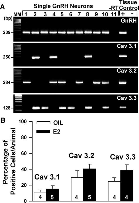 17β Estradiol Regulation of T Type Calcium Channels in Gonadotropin