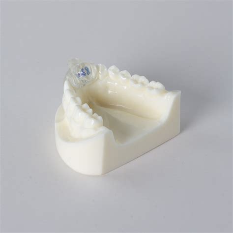 Bruxism – S4S Dental