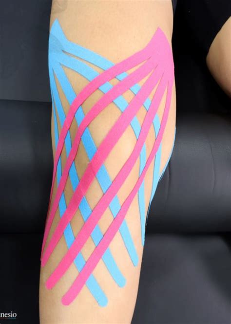 What Is The Kinesio Taping Method Kinesio