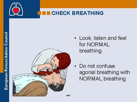 European Resuscitation Council ADULT BASIC LIFE SUPPORT BLS