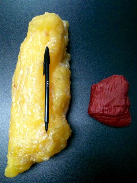 Fat vs. Muscle: Understanding The Truth Behind The Images