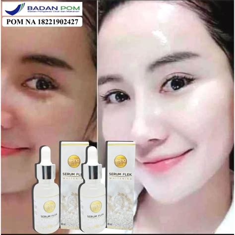 Jual Serum Penghilang Flek Hitam Bikin Glowing Permanen Serum Erna