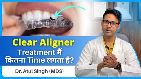 Clear Aligner Treatment मैं कितना Time लगता है How Long Will Clear