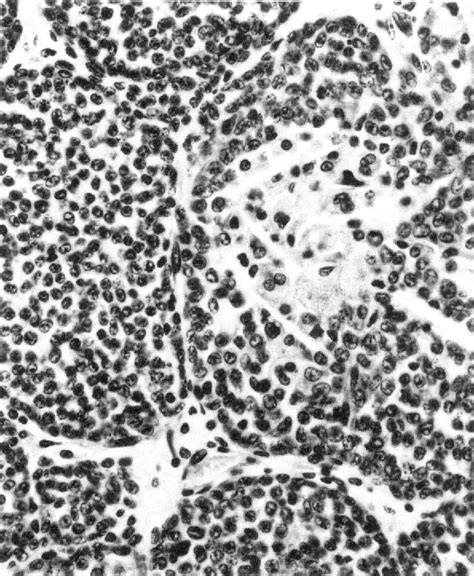 Figure 15 From Proliferative Lesions In The Male Reproductive System Of F344 Rats And B6c3f1