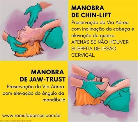 Manobrastrauma Traumatologia E Ortopedia