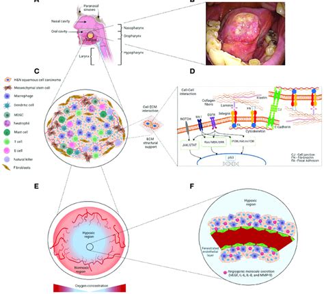 Schematic Representation Of The Potential Tumor Location And Tumor