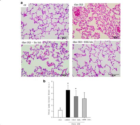 Histological Analysis Of Lung Tissue Section Following IRB And The