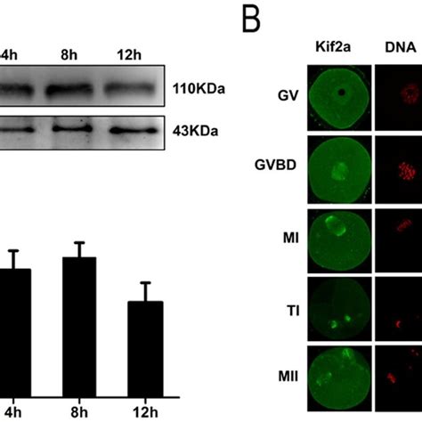 Expression And Subcellular Localization Of Kif A During Mouse Oocyte