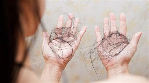 How To Stop Hair Fall In Rainy Season बरसात के मौसम में बालों झड़ना