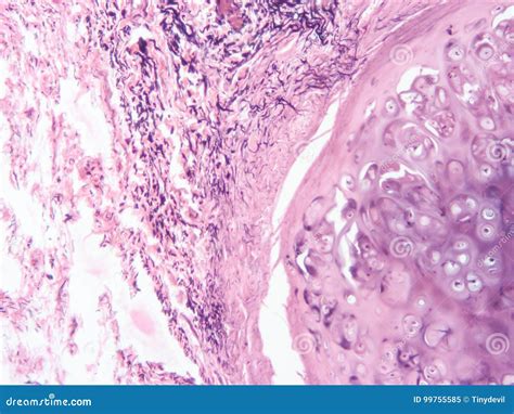 Histology Of Cartilage Human Tissue Royalty-Free Stock Photography | CartoonDealer.com #99755585