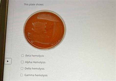 Solved This plate shows: Beta hemolysis Alpha Hemolysis O | Chegg.com