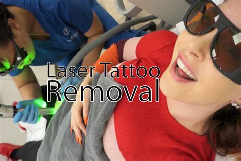 Pulse Light Clinic Laser Tattoo Removal Tracy Kiss