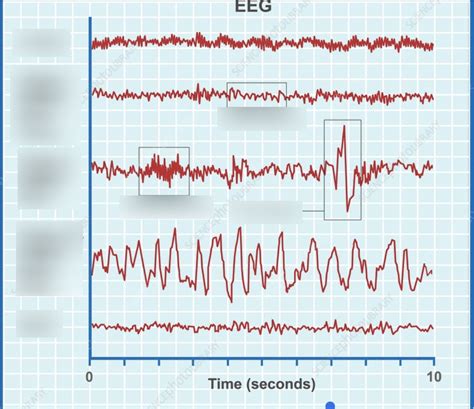 Eeg Diagram Quizlet