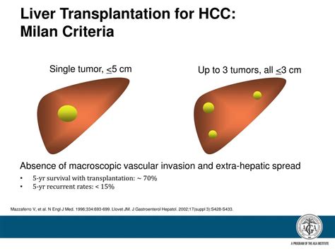 Ppt Primary Liver Cancer Hepatocellular Carcinoma And