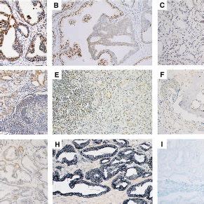 Histologic Analysis Immunohistochemistry And In Situ Hybridization Of