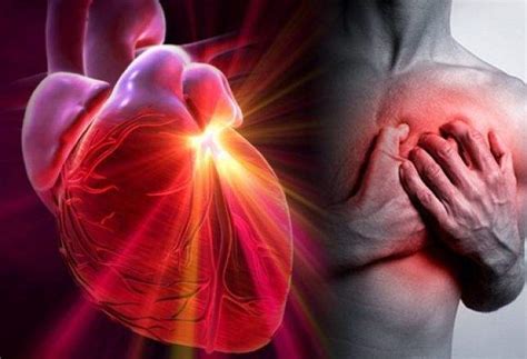 Infarto Miocardico Conoscere Per Sopravvivere Ecco Come