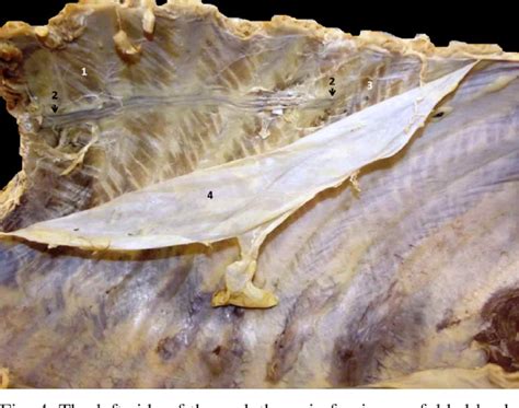 Figure From Lateral Bilateral Costal Branch R Costalis Lateralis