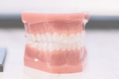 Coca Na Real Extremadamente Gomas Invisalign Duracion Ocio Est Tico Experto