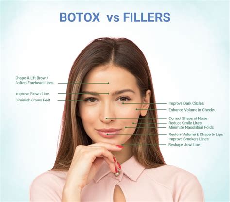 Botox Injection In Dubai Dubai Cosmetic Surgery Clinic Botox Nasolabial Folds Botox Injections