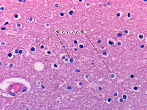 Oligodendrocytes Histology