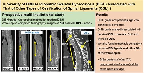 Jcm Free Full Text Association Between Severity Of Diffuse Idiopathic Skeletal Hyperostosis